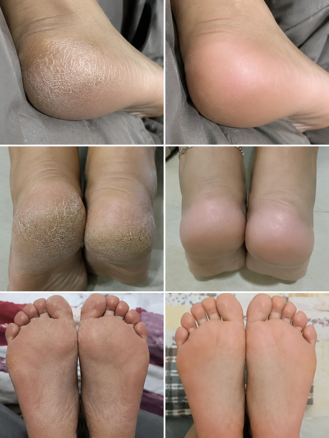 Smooth Foot Cream